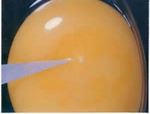 Infertile yolk