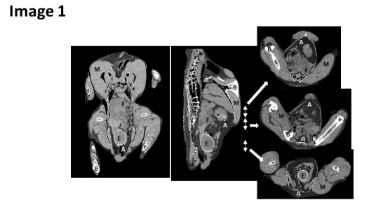 ct scan image 1