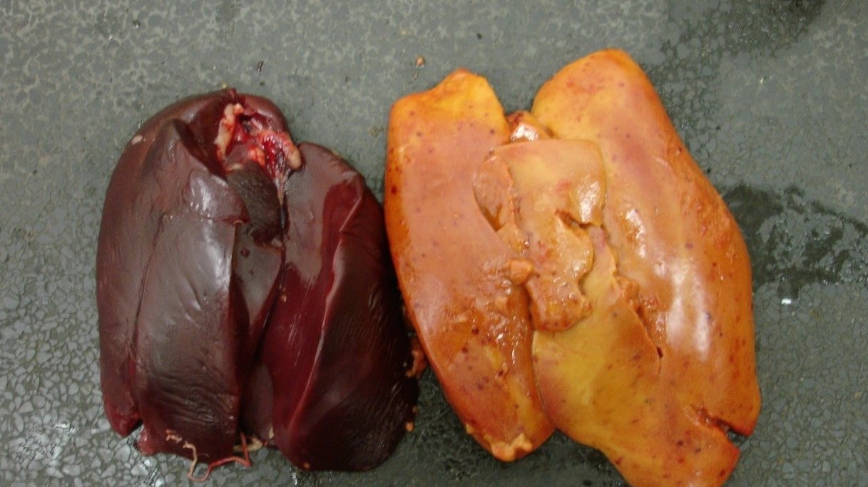 fatty liver 1.jpg