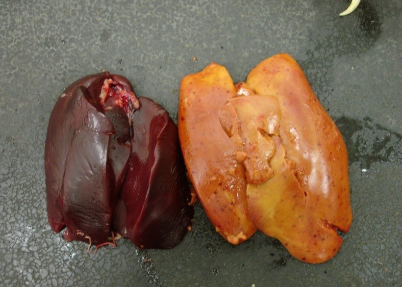 The importance of a healthy liver